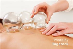 Fire Cupping