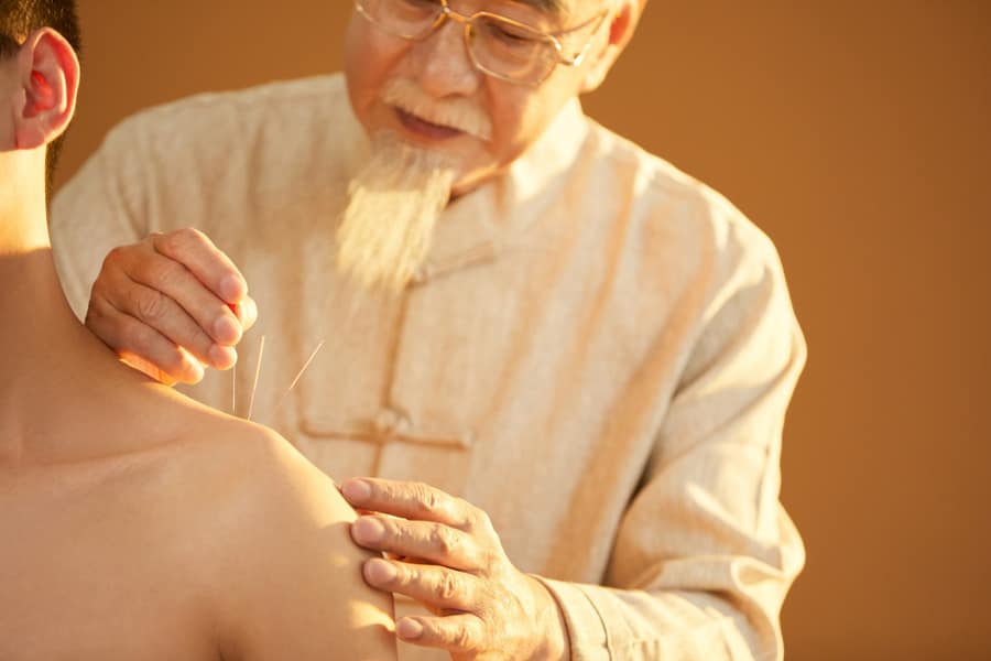 acupuntura